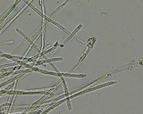 Capitotricha bicolor image
