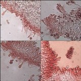 Chaetocalathus craterellus image