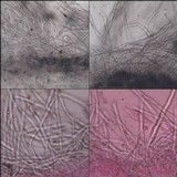 Chaetocalathus craterellus image
