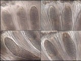 Phlyctis agelaea image