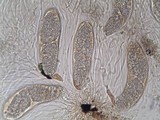 Phlyctis agelaea image