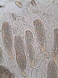 Phlyctis agelaea image