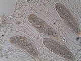 Phlyctis agelaea image