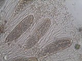 Phlyctis agelaea image