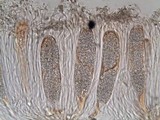 Phlyctis agelaea image