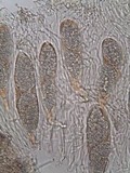 Phlyctis agelaea image