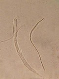 Lophium mytilinum image