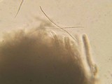 Lophium mytilinum image