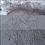Chaetocalathus craterellus image