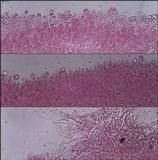 Chaetocalathus craterellus image