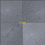 Chaetocalathus craterellus image