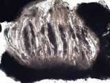 Pertusaria hymenea image