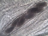 Pertusaria hymenea image