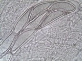 Pertusaria hymenea image