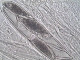 Pertusaria hymenea image