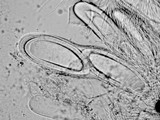 Pertusaria lecanina image