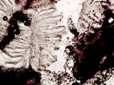 Pertusaria lecanina image