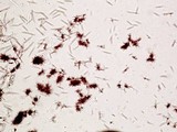 Pertusaria lecanina image
