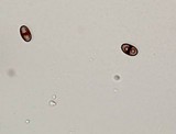 Buellia halonia image