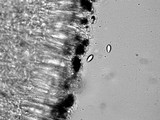 Lecanora caesiorubella image