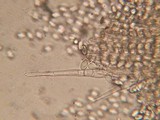 Pyronema domesticum image