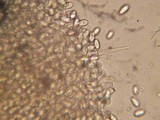 Pyronema domesticum image