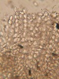 Pyronema domesticum image