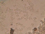 Pyronema domesticum image