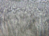 Ascocoryne sarcoides image