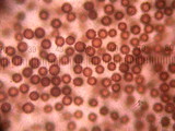 Scleroderma areolatum image