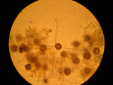 Scleroderma areolatum image