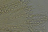 Cheilymenia fimicola image