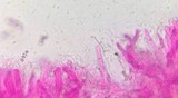 Dacrymyces capitatus image