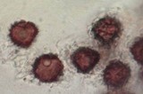 Scleroderma laeve image