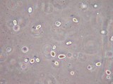 Cuphophyllus virgineus image