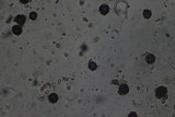 Scleroderma cepa image