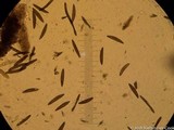 Xylaria comosoides image