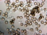 Reticularia intermedia image