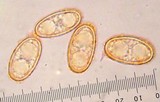 Humaria hemisphaerica image