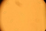 Cudoniella acicularis image