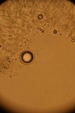 Penicillium vulpinum image