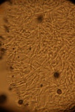 Penicillium vulpinum image