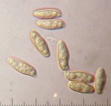 Xerocomellus atropurpureus image