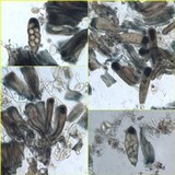 Lecidella elaeochroma f. soralifera image