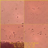Hygrocybe monteverdae image