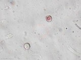 Fomitiporia robusta image