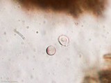 Fomitiporia robusta image