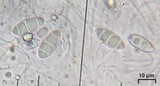 Lithothelium hyalosporum image