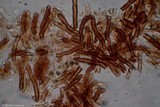 Fomitiporia robusta image