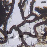 Lichenostigma cosmopolites image